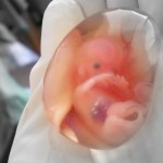8-недельный Эмбрион в амнионе (10-я неделя беременности), извлечённый в результате  аборта. Фото:  dic.academic.ru 